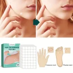 Natural Skin Tag Remover Patches - Image 3
