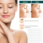 Natural Skin Tag Remover Patches - Image 4